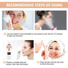 Portable Electric Blackhead Remover