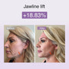 DermRays Multifunctional Microcurrent Facial Device