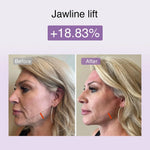 DermRays Multifunctional Microcurrent Facial Device