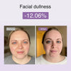 DermRays Multifunctional Microcurrent Facial Device