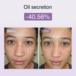 DermRays Multifunctional Microcurrent Facial Device