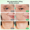 Electric Microcurrent Facial Massager