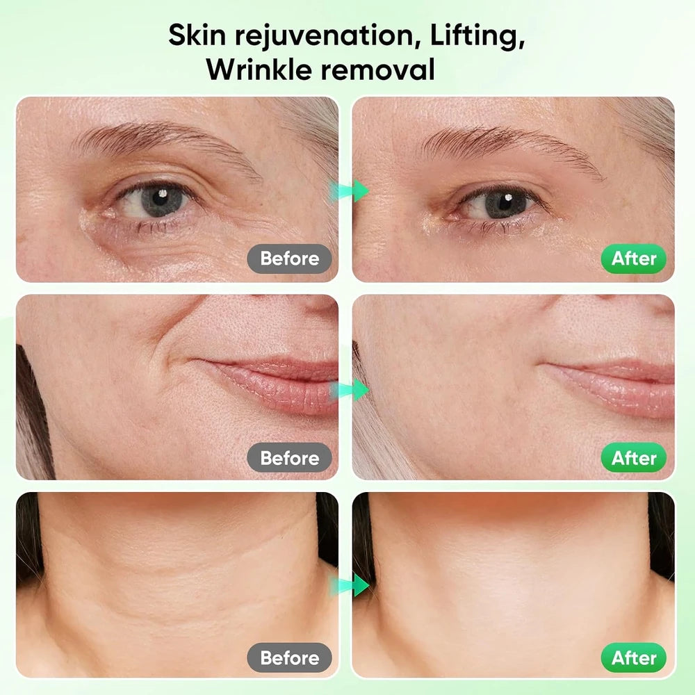 Electric Microcurrent Facial Massager