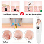 Portable Electric Blackhead Remover